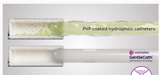 Why should you think about the urethral lining?