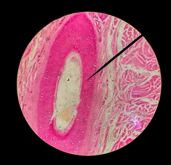 Appraising evidence: putting research into practice for nurses